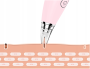 Odkurzacz do wągrów, zaskórników Xiaomi InFace Electric Blackhead Removal - różowy
